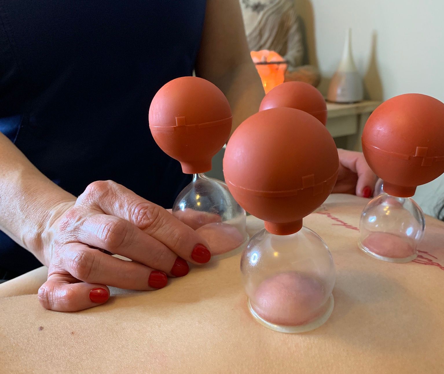 Cupping Therapy